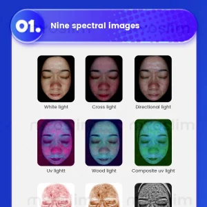 AI 3D Facial Skin Analyzer - Thumbnail Image 5