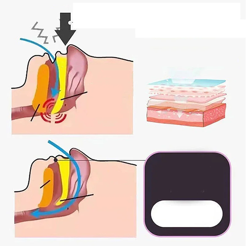 Gentle Sleep Mouth Tape - Image 5