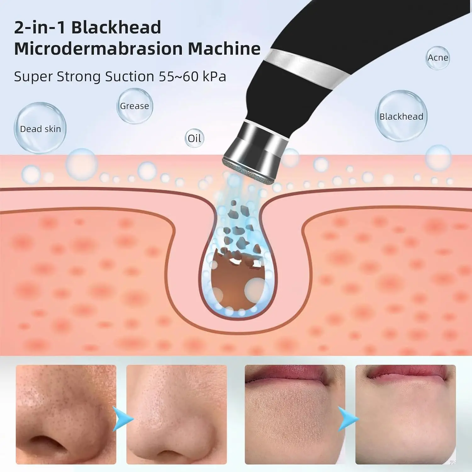 Deep Clean Facial Exfoliator - Image 3
