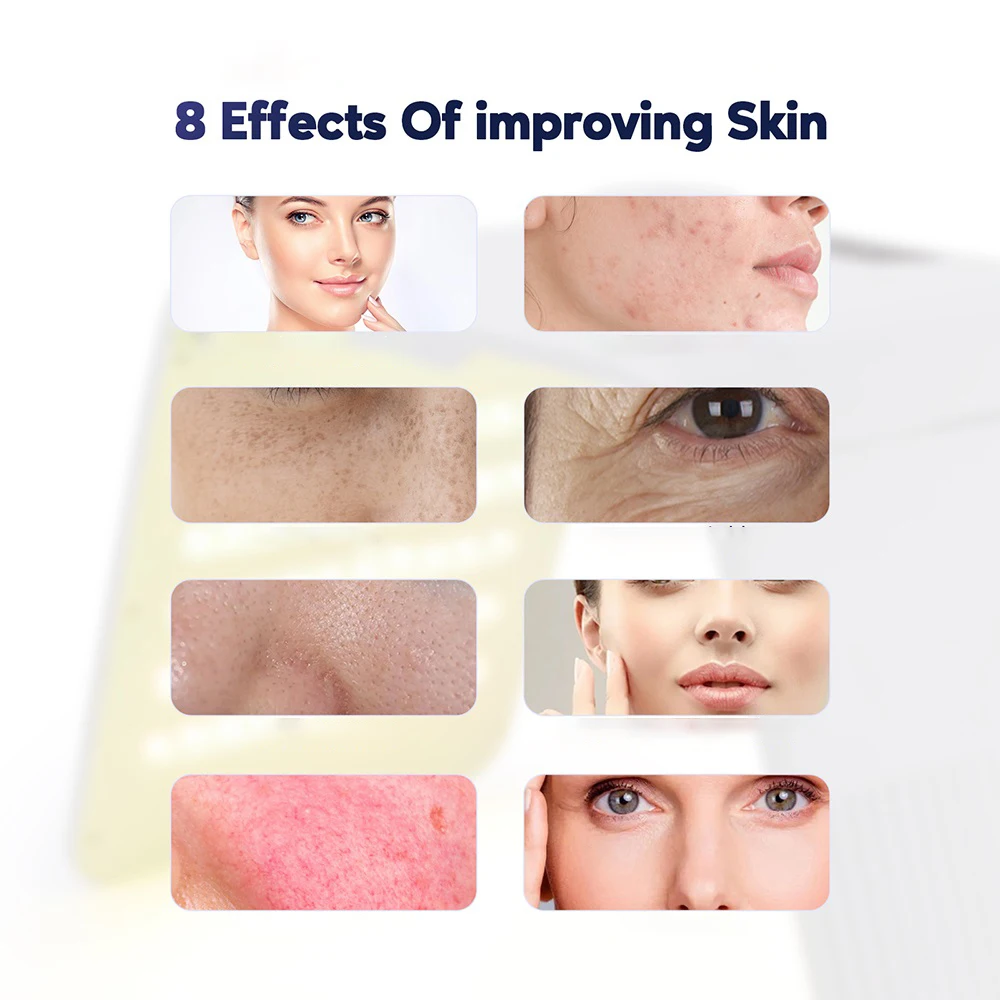 7-Color LED Facial Spa Device - Image 4